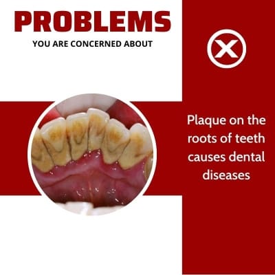 Picture of Jaysuing Niacinamide toothpaste aqua cool teeth whitening stain removal 100g