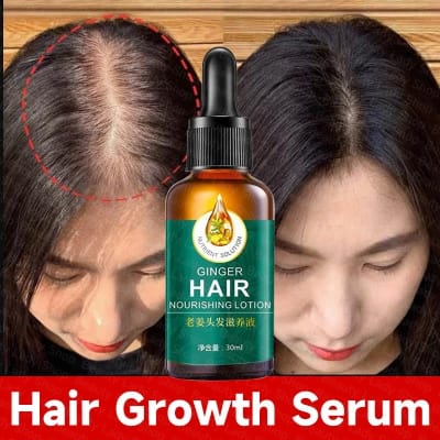 Picture of 100% Natural Ginger Hair Serum Hair Grower Fast Long Hair Treatment Minoxidil Hair Grower Castor Oil For Essence Preventing Baldness Consolidate Hair Loss Treatment repairs the hair improves hair loss hair growth serum 10 x faster