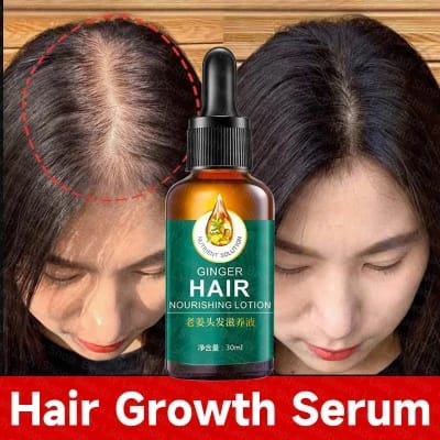 Picture of 100% Natural Ginger Hair Serum Hair Grower Fast Long Hair Treatment Minoxidil Hair Grower Castor Oil For Essence Preventing Baldness Consolidate Hair Loss Treatment repairs the hair improves hair loss hair growth serum 10 x faster