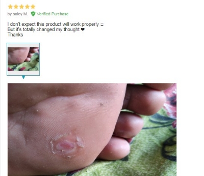 Picture of Plasters Foot Corn Removal 6pcs - Fresh