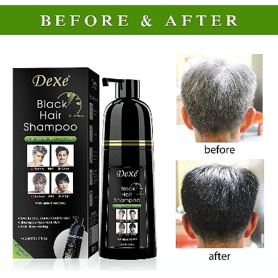 Picture of Dexe Black Hair Shampoo Made in UK 400ml - 400ml