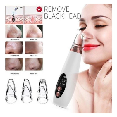 Picture of Rechargeable Electric Blackhead Acne Oil Remover Vacuum Suction Face Pore Cleaner Facial Beauty Equipment, Blackhead Removal Machine