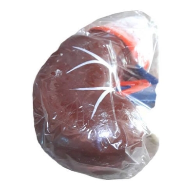 Picture of Human Kidney Artificial Model