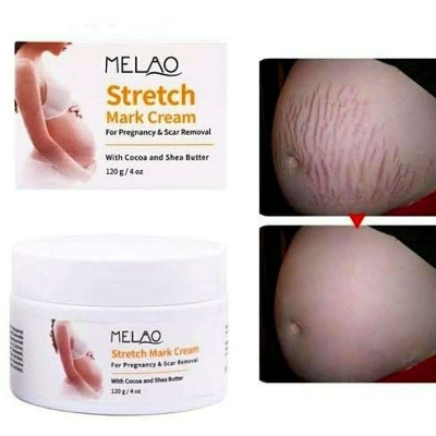 Picture of Stretch Mark Cream, Postpartum Obesity Cream, Remove Stretch Marks, Repair Scar Slack Line Abdomen Stretch Marks Postpartum 120g