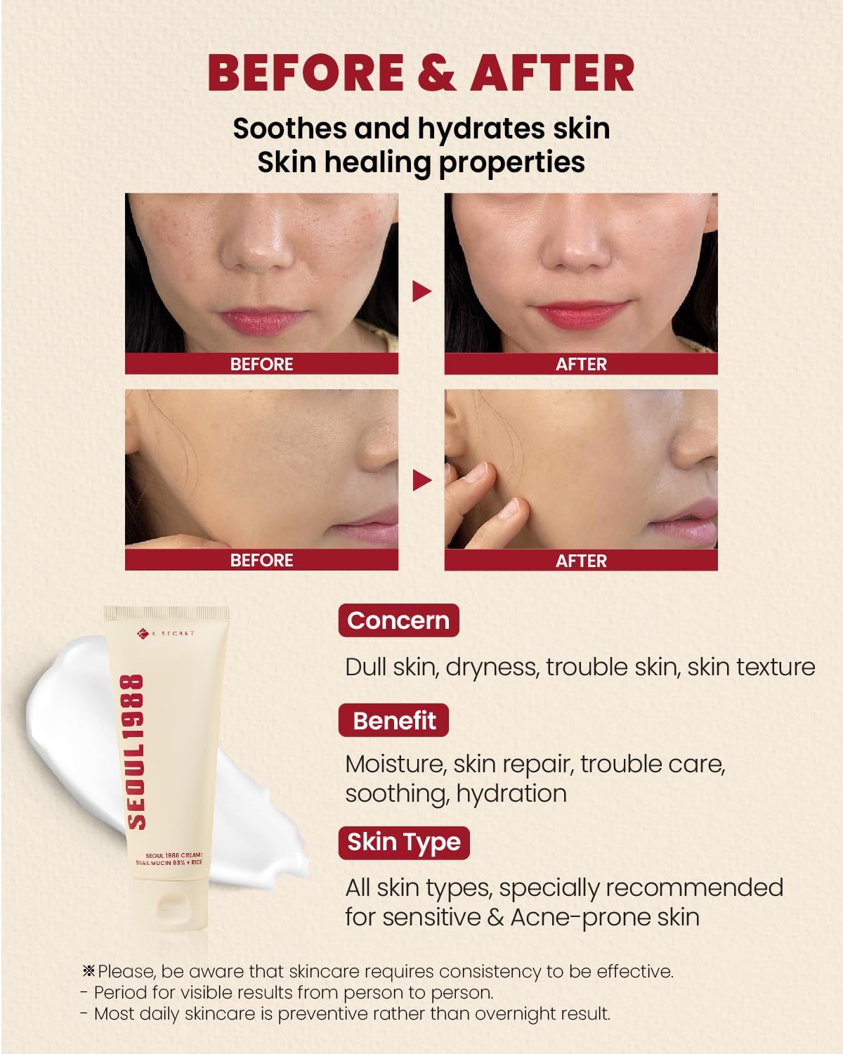 Picture of KSECRET SEOUL 1988 EYE CREAM : RETINAL LIPOSOME 4% + FERMENTED BEAN 30ML