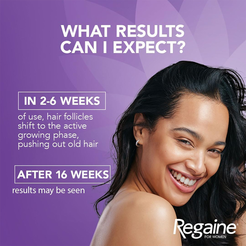 Picture of Women's Rogaine Topical Solution Hair Regrowth Treatment 2% Minoxidil for Women - 60 ml 30 Days Supply - MNXWS