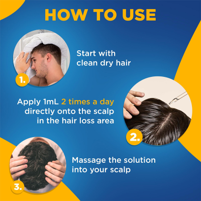 Picture of Kirkland Minoxidil 5% Topical Solution Extra Strength Hair Regrowth Treatment for Men Hair & Beard Drop + Derma Roller Free - (1 month supply) - MNXMC