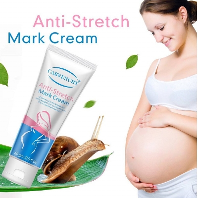 Picture of Aichun Beauty Anti-Stretch Mark Cream.