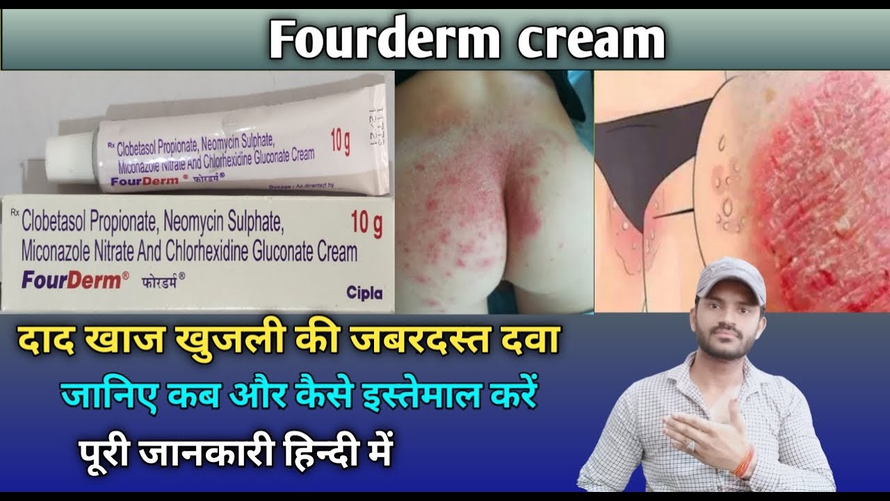 Picture of Fourderm Cream 20g India