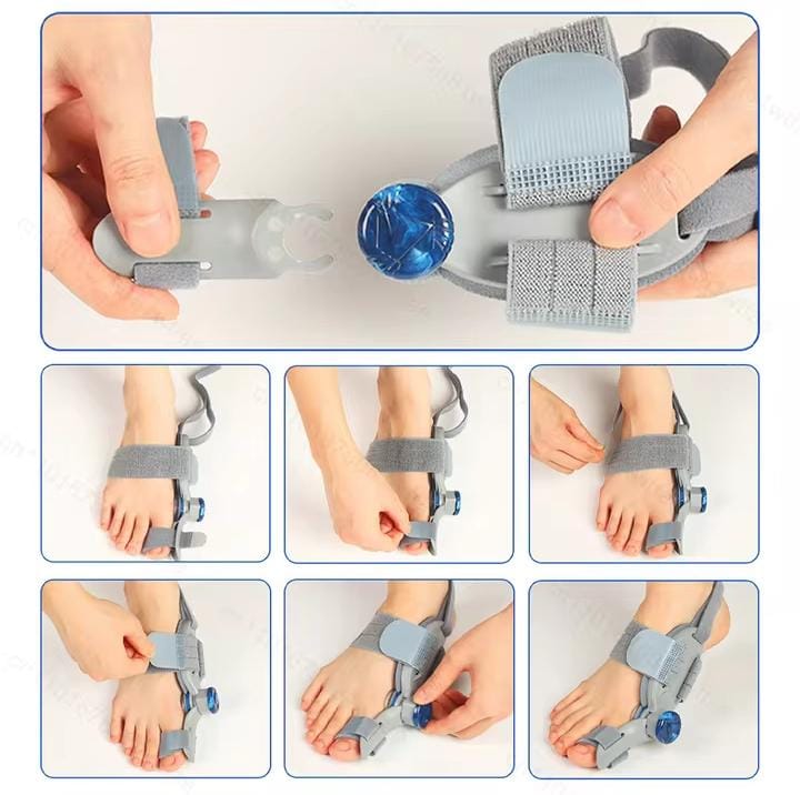 Picture of Bunion Corrector for Women & Men Big Toe: Adjustable Bunion Fix for Big Toe Separation Pain Relief - Orthopedic Bunion Splint with Straightener for Toes Alignment Hallux Valgus Correction