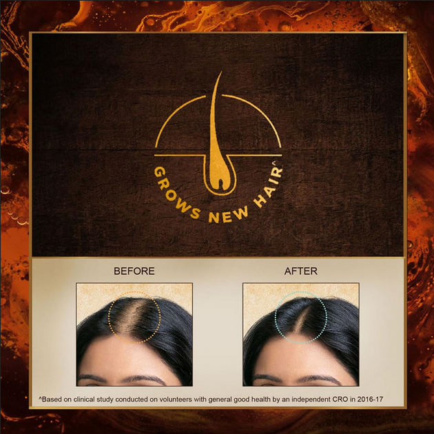 Picture of Indulekha Bringha Oil, Reduces Hair Fall and Grows New Hair, 100% Ayurvedic Oil 100 ml