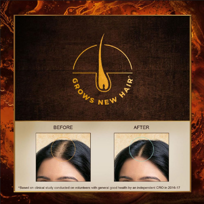 Picture of Indulekha Bringha Oil, Reduces Hair Fall and Grows New Hair, 100% Ayurvedic Oil 100 ml