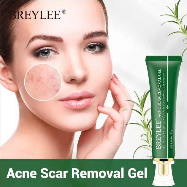 Picture of BREYLEE Acne Scar Removal Gel-30g