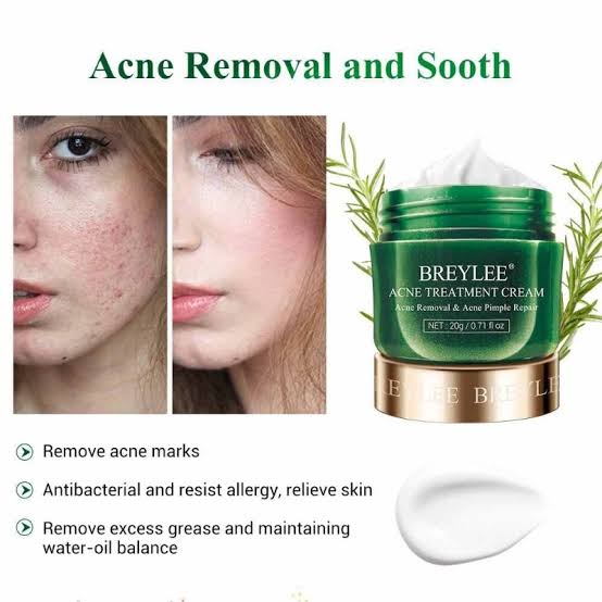 Picture of BREYLEE Acne Treatment Cream 20 gm