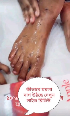 Picture of Pomegranate Gel Peeling Gel Skin Care Deep Cleansing Gel 250ml