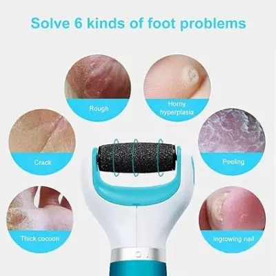 Picture of USB rechargeable electronic foot file foot pedicure tool, perfect foot cleaner, electric callus remover, used for cracked heel and dead skin, a total of 2 rolling grinding heads
