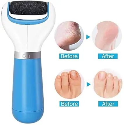 Picture of USB rechargeable electronic foot file foot pedicure tool, perfect foot cleaner, electric callus remover, used for cracked heel and dead skin, a total of 2 rolling grinding heads