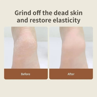 Picture of DOCO F002 Electric Callus Remover Pedicure Dead Skin

(1 year replacement warranty) - White