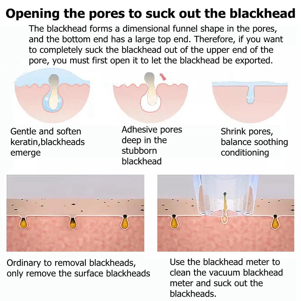 Picture of Xiaomi inFace MS7000 Blackhead Remover - White