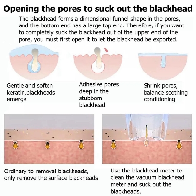 Picture of Xiaomi inFace MS7000 Blackhead Remover - White