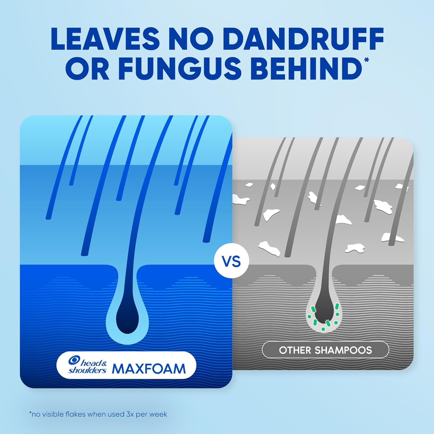 Picture of Head & Shoulders Shampoo 400ml