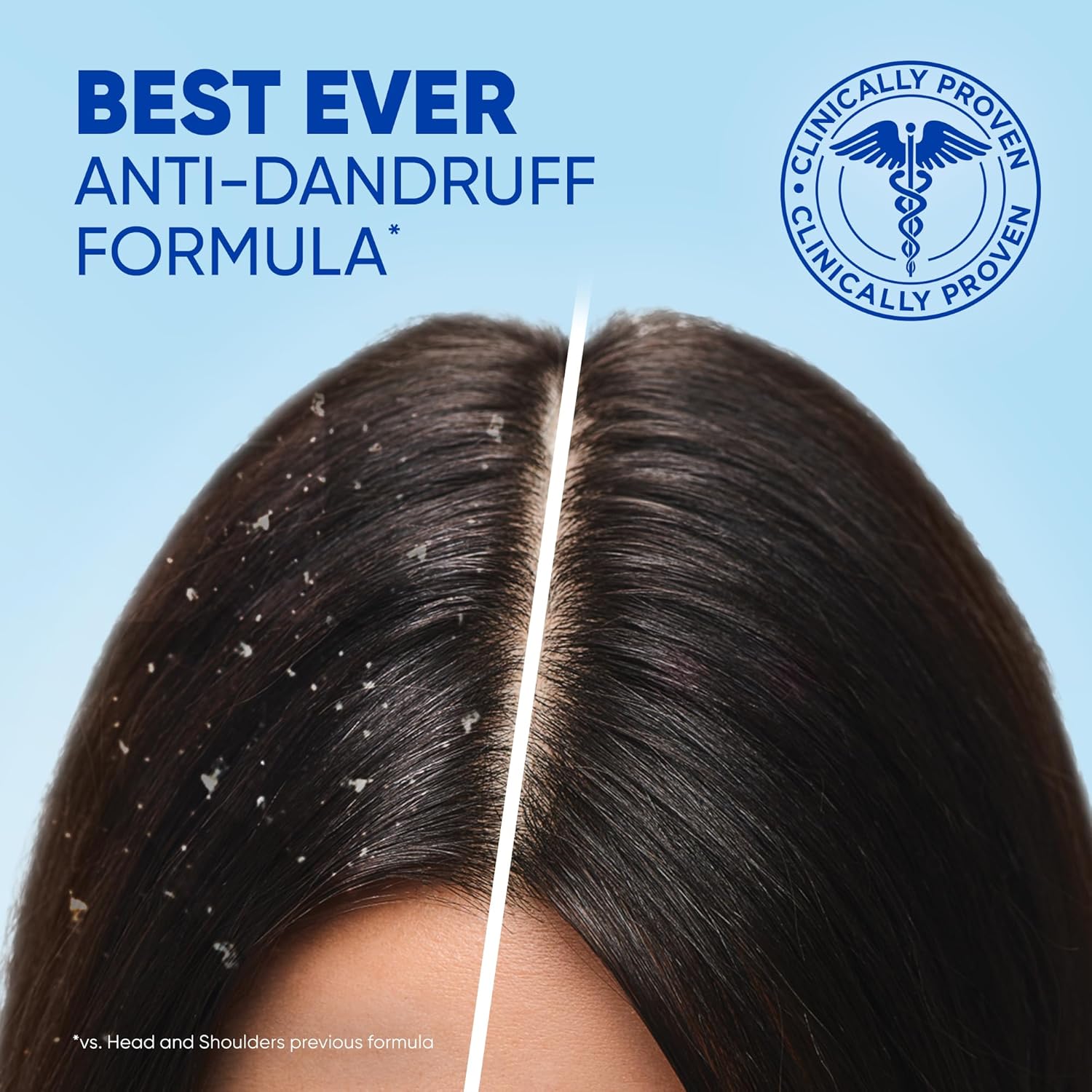 Picture of Head & Shoulders Shampoo 400ml