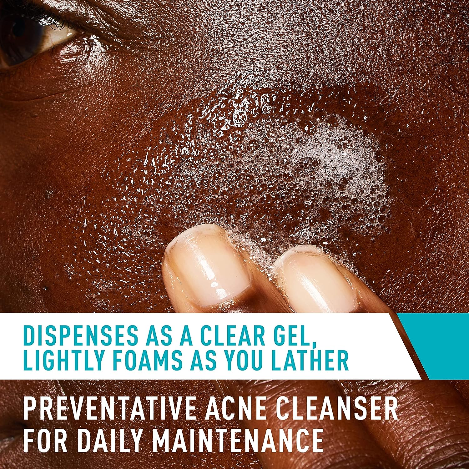 Picture of CeraVe Acne Treatment Face Wash | Salicylic Acid Cleanser for Oily Skin | Blackhead Remover | Fragrance Free