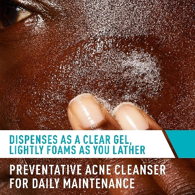 Picture of CeraVe Acne Treatment Face Wash | Salicylic Acid Cleanser for Oily Skin | Blackhead Remover | Fragrance Free