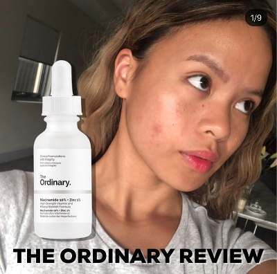 Picture of The Ordinary Niacinamide 10%+Zinc1%