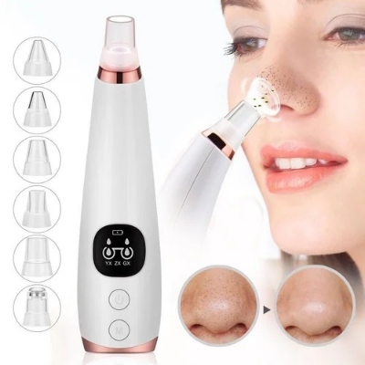Picture of 6-in-1 Electric Blackhead Remover – USB Rechargeable Derma Suction Pore Cleaner for Acne & Skin Care (White) ( White )