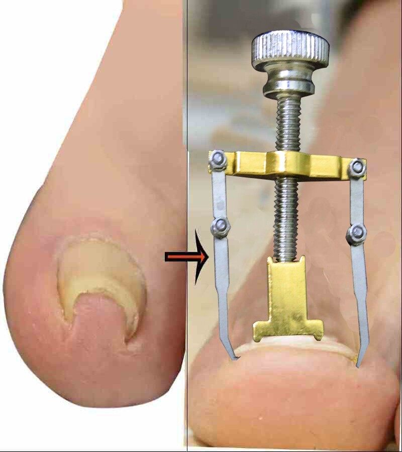 Picture of Nail Care Machine for Nail Repair Professional Salon Quality Manicure Pedicure Tool Kit ( Multicolor )