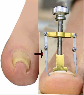 Picture of Nail Care Machine for Nail Repair Professional Salon Quality Manicure Pedicure Tool Kit ( Multicolor )