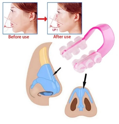Picture of NOSE UP CLIP - NOSE LIFTER, NOSE SHAPER, NOSE CORRECTOR