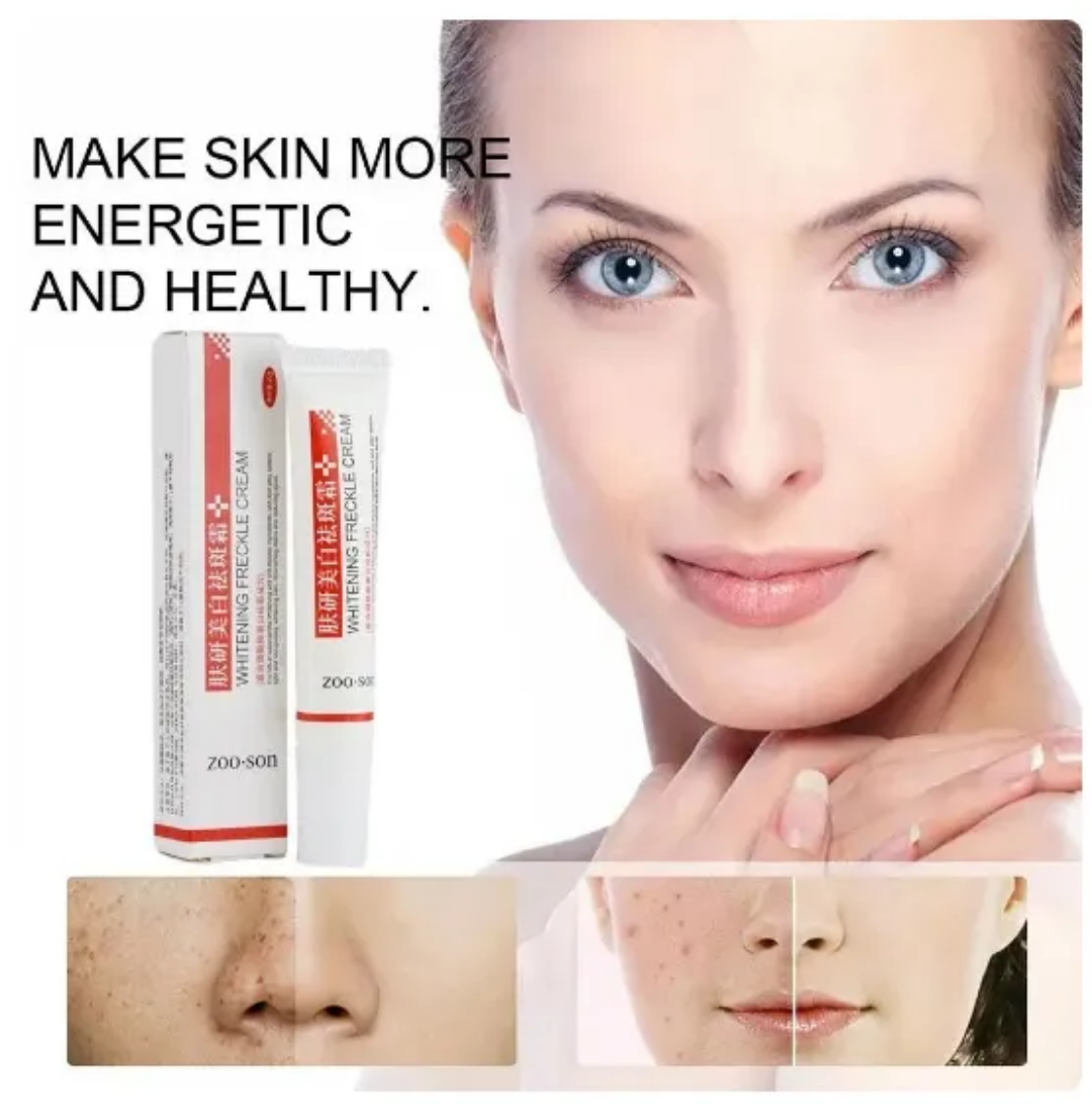 Picture of Zoo Son Whitening Freckle Cream