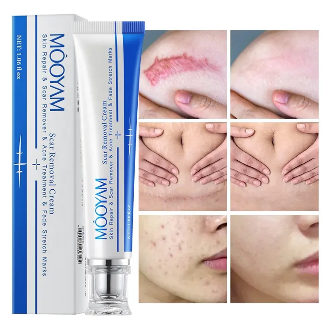 Picture of MOOYAM Scar Removal Cream