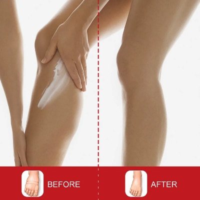 Picture of Sumifun Leg Edema Relief Cream 20g