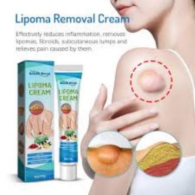 Picture of South Moon Lipoma Removal Cream Lipolysis Fat Lump Relieve Plaster Skin Swelling Ointment Subcutaneous Lumps Dredge Dissipate Body Care（20g）