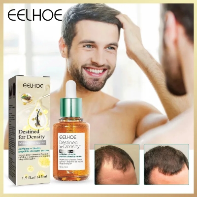 Picture of Eelhoe Biotin Fast Hair Growth Oil Hair Regrowth Serum Prevent Baldness Scalp Massage Treatment Hair Growth Liquid Anti-Hair Loss for Women and Men