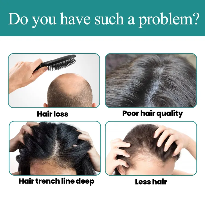 Picture of Eelhoe Biotin Fast Hair Growth Oil Hair Regrowth Serum Prevent Baldness Scalp Massage Treatment Hair Growth Liquid Anti-Hair Loss for Women and Men