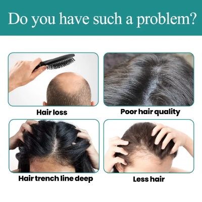 Picture of Eelhoe Biotin Fast Hair Growth Oil Hair Regrowth Serum Prevent Baldness Scalp Massage Treatment Hair Growth Liquid Anti-Hair Loss for Women and Men