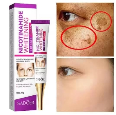 Picture of Sadoer Nicotinamide Whitening Freckle Cream 20g Lighten Dark Spots