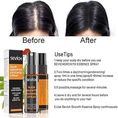 Picture of SEVICH Hair Growth Essence Spray - Natural Fragrance Free Hair Care for Men and Women, 30ml, Hair Loss & Thinning Prevention Treatment, Scalp Improver, Biotin for Healthy Hair