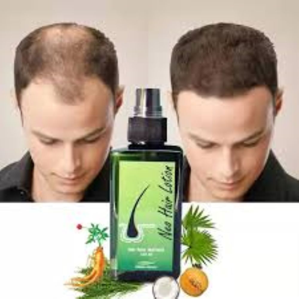 Picture of Neo Hair Lotion - Hair Root Nutrients - 120mL (Made in Thailand)