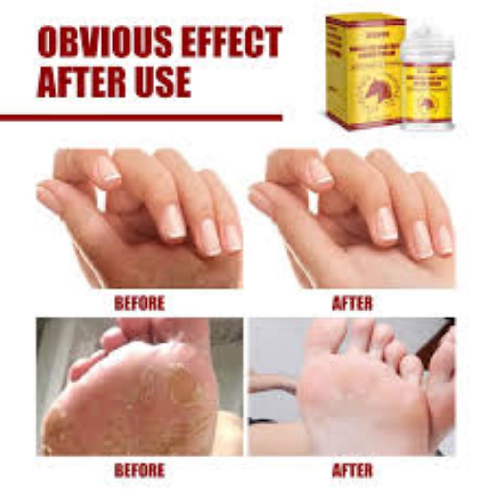 Picture of Eelhoe Horse Oil Brother Skin Repair Cream-50gm