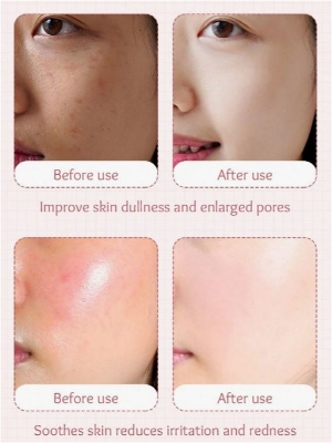 Picture of SADOER Hydro Boost Milk Peach Moisture & Nourish Serum- 30ml