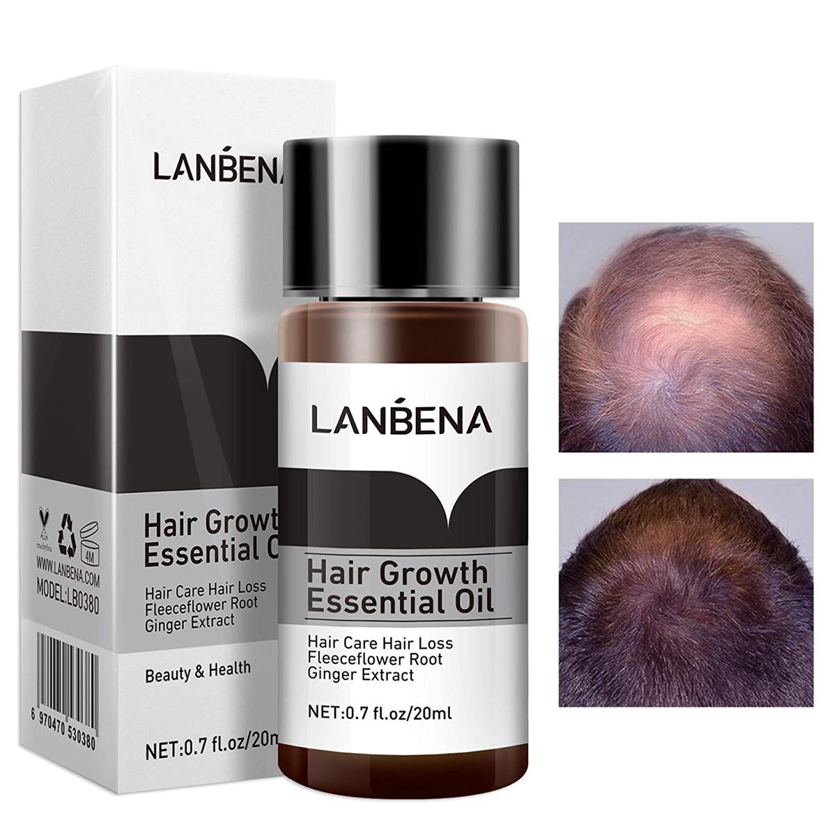 Picture of Lanbena Hair Growth Essential Oil
