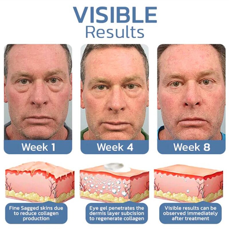 Picture of OPENEYES Awaken Peptide Lifting Eye Gel Himse Awaken Peptide Depuffing Eye Gel for Reduces Puffiness Under Eye Bags, Wrinkle