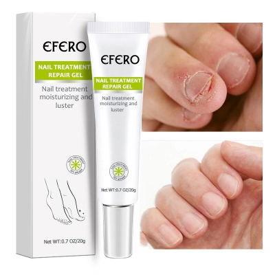 Picture of Nail Cream Treatment Repair Gel Moisturizing and Luster