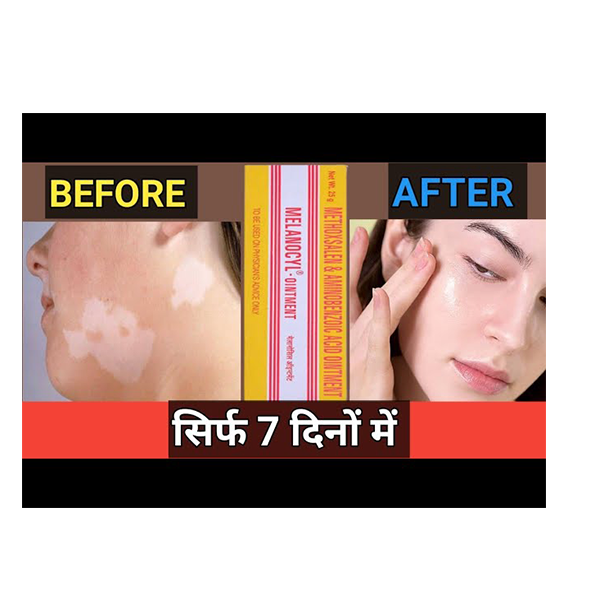 Picture of Indian Melanocyl Ointment  25g