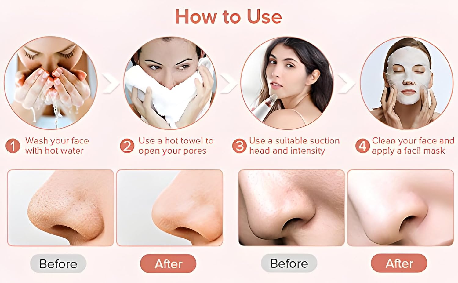 Picture of 6 In 1 Multi-Function Blackhead Remover Tool, USB Rechargeable Derma suction Machine, Pimple Removal Tool for Men and Women